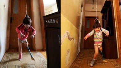 Özge Yıldırım'a Bacak Nakli Umudu Doğdu!