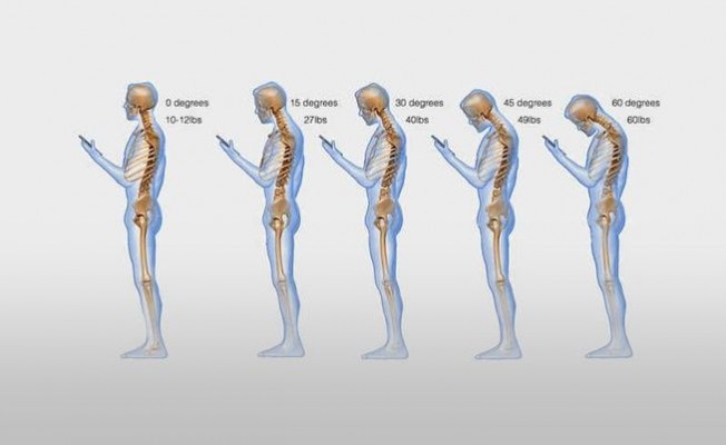 Cep Telefonları Omurgayı Ciddi Anlamda Etkiliyor