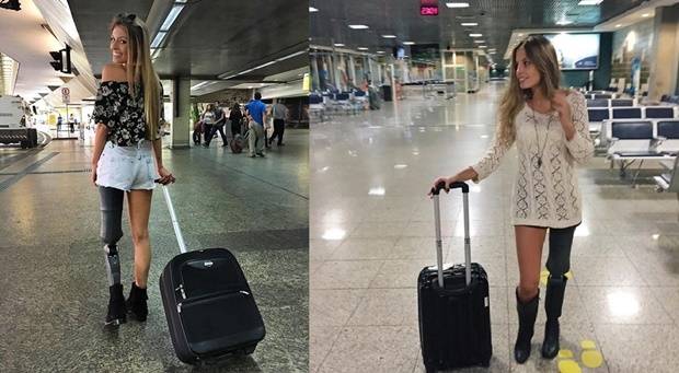 Protez Bacağıyla Hayata Meydan Okuyan Kadın 4