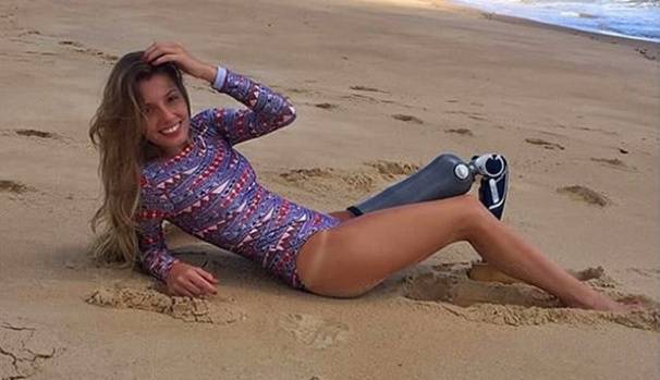 Protez Bacağıyla Hayata Meydan Okuyan Kadın 3