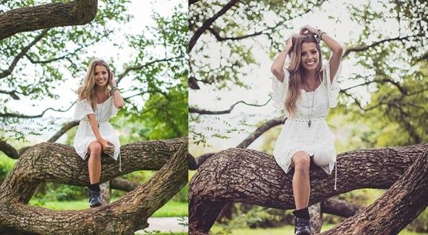 Protez Bacağıyla Hayata Meydan Okuyan Kadın 5