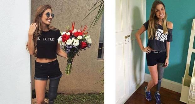 Protez Bacağıyla Hayata Meydan Okuyan Kadın 2