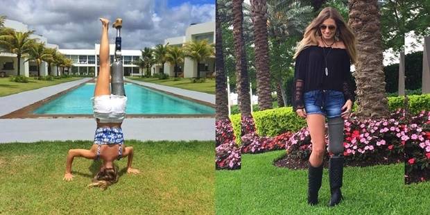 Protez Bacağıyla Hayata Meydan Okuyan Kadın 6